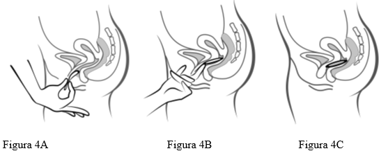 Anello vaginale e on sale rapporti